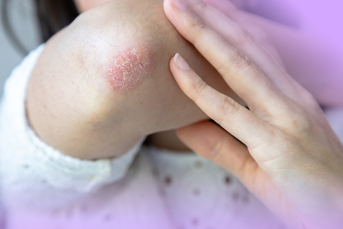 Autoimmune Freedom Image